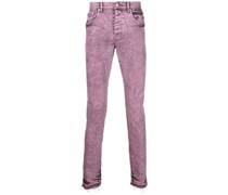 Skinny-Jeans mit Bleach-Effekt