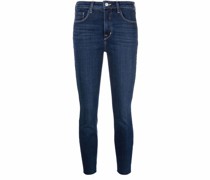 Skinny-Jeans