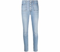 Skinny-Jeans mit Knopfleiste