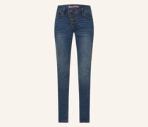 Skinny Jeans MALIBU